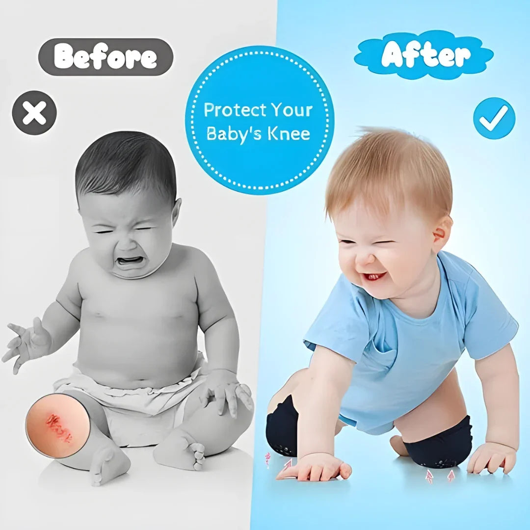 2 Pair Baby Knee Pad For Safety Crawling
