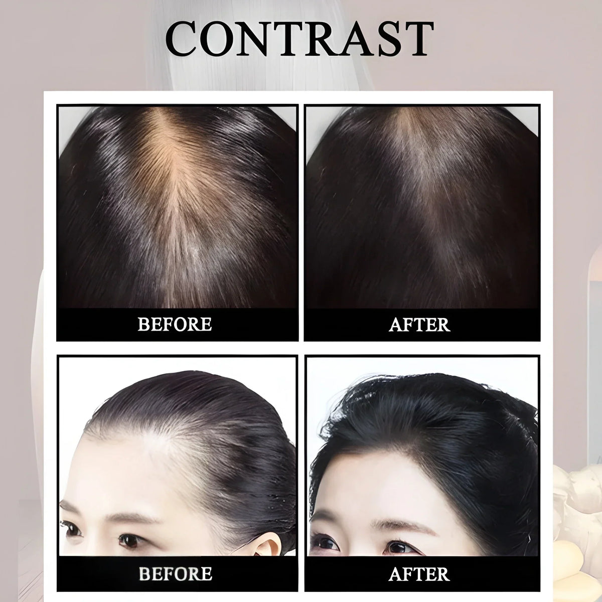 Anti-Hair Loss Growth Spray