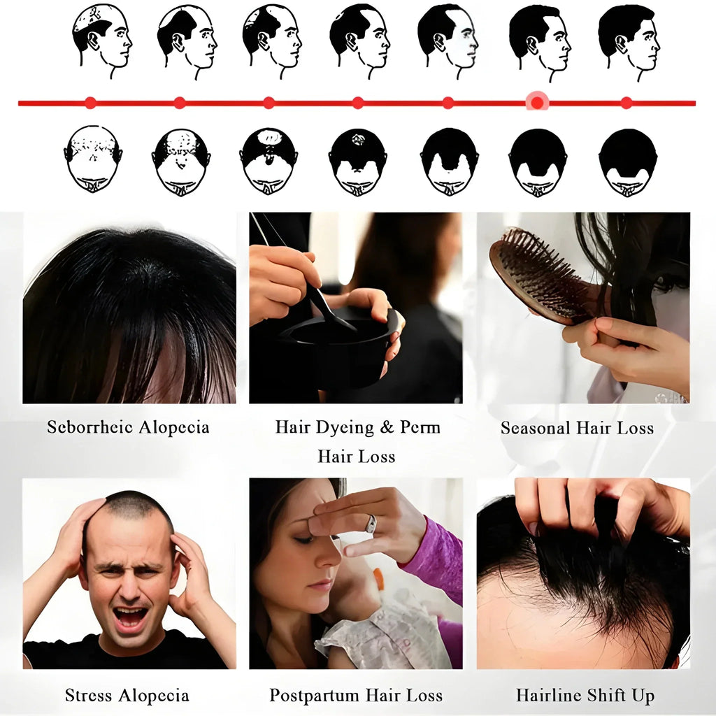 Anti-Hair Loss Growth Spray