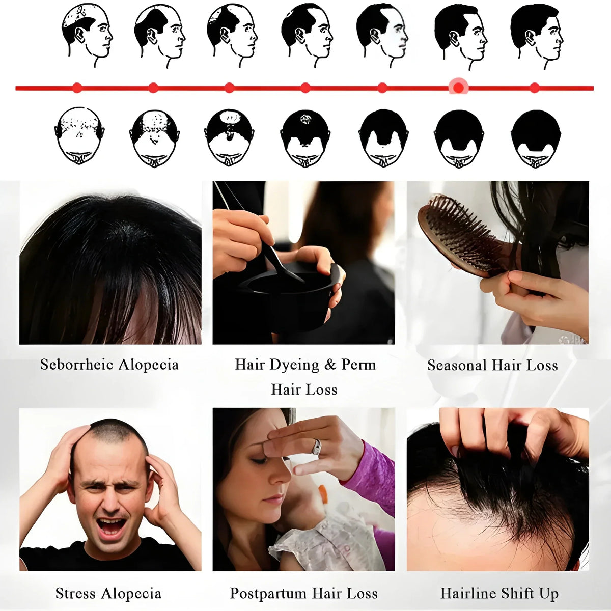 Anti-Hair Loss Growth Spray